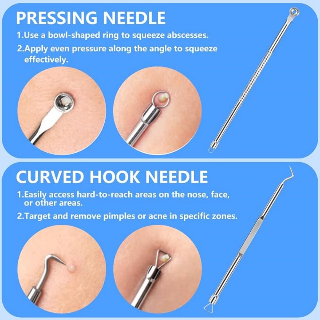 5PCS Blackhead Remover Comedon - огляд і ціна Luxury Skincare Acne