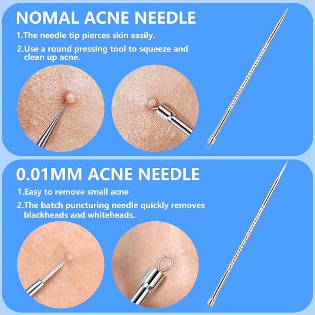 5PCS Blackhead Remover Comedon - огляд і ціна Luxury Skincare Acne