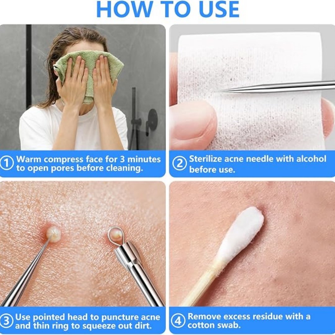 5PCS Blackhead Remover Comedon - огляд і ціна Luxury Skincare Acne